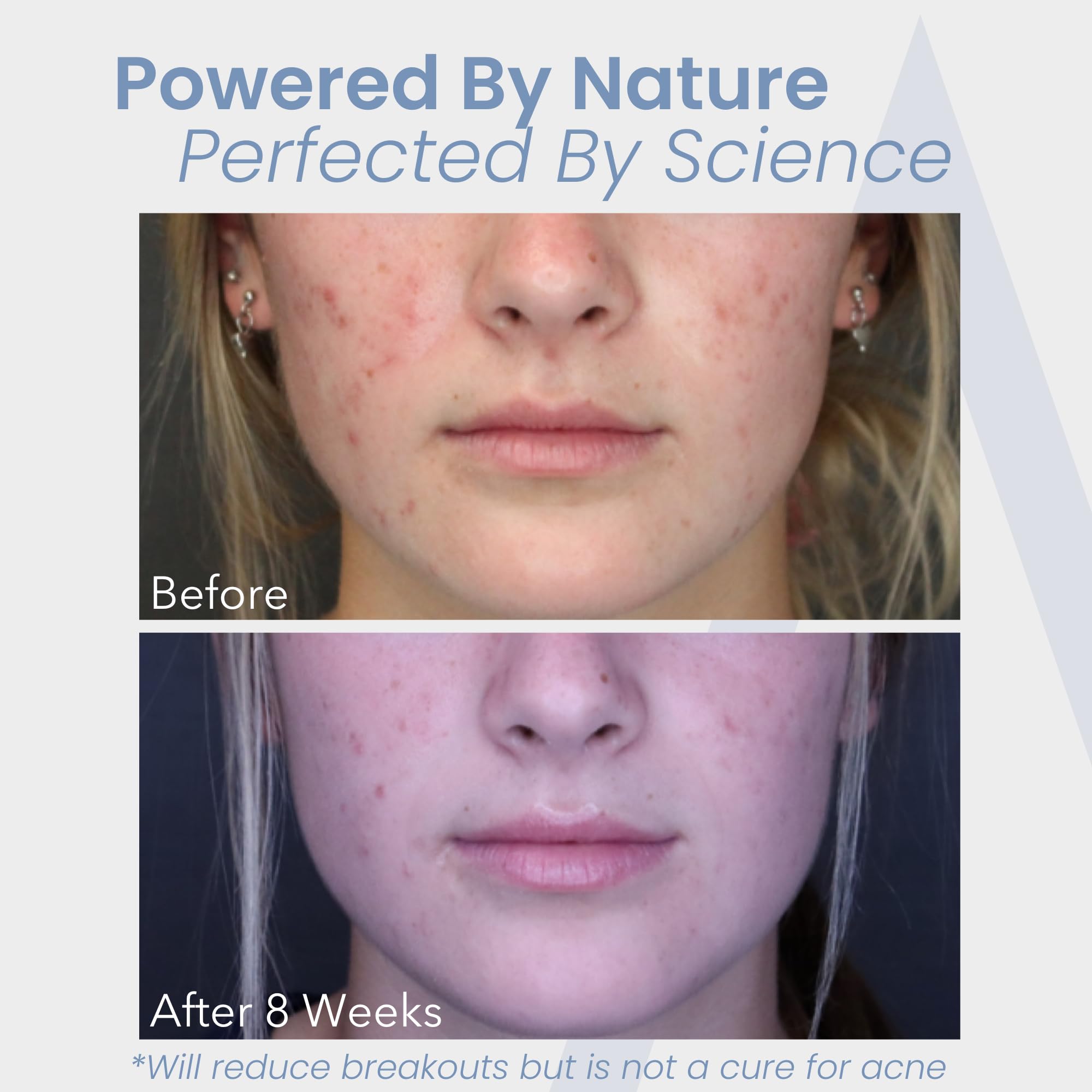 Augamis DIM-free sign highlights avoidance of estrogen-impacting compounds