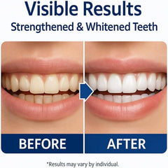 Aultink Irmi Remineral Tooth Armor fluoride-free formula for sensitive teeth.
