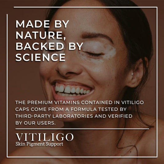 Aura Vitamins Dermawonder Vitiligo Capsules close-up shows smooth capsules for daily use.