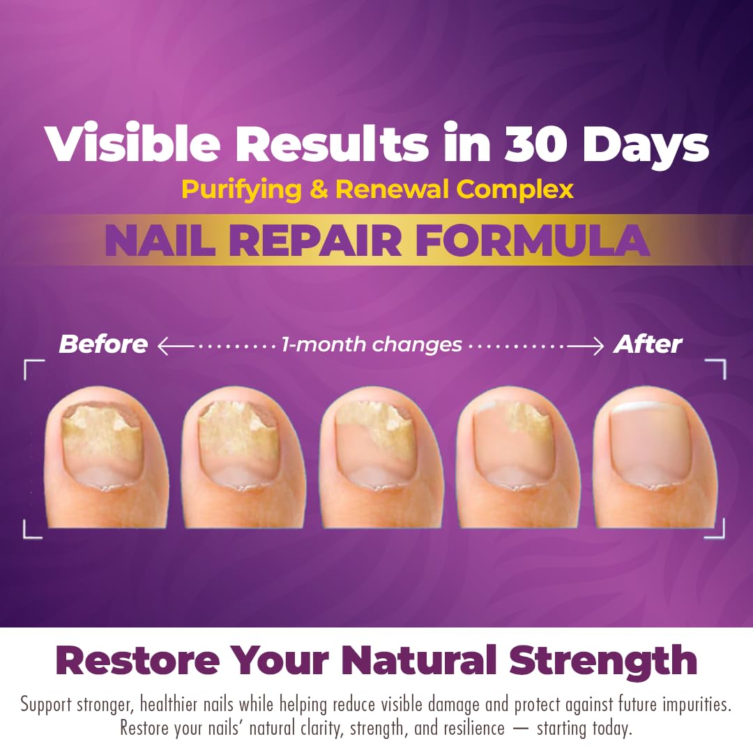 Aura Vitamins FungiTrim hands with nails after daily use appear healthier