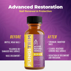 Aura Vitamins FungiTrim key ingredients tea tree and lavender blend