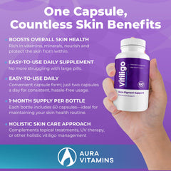 Aura Vitamins Vitiligo Capsules in hand conveys ease of use in routine.