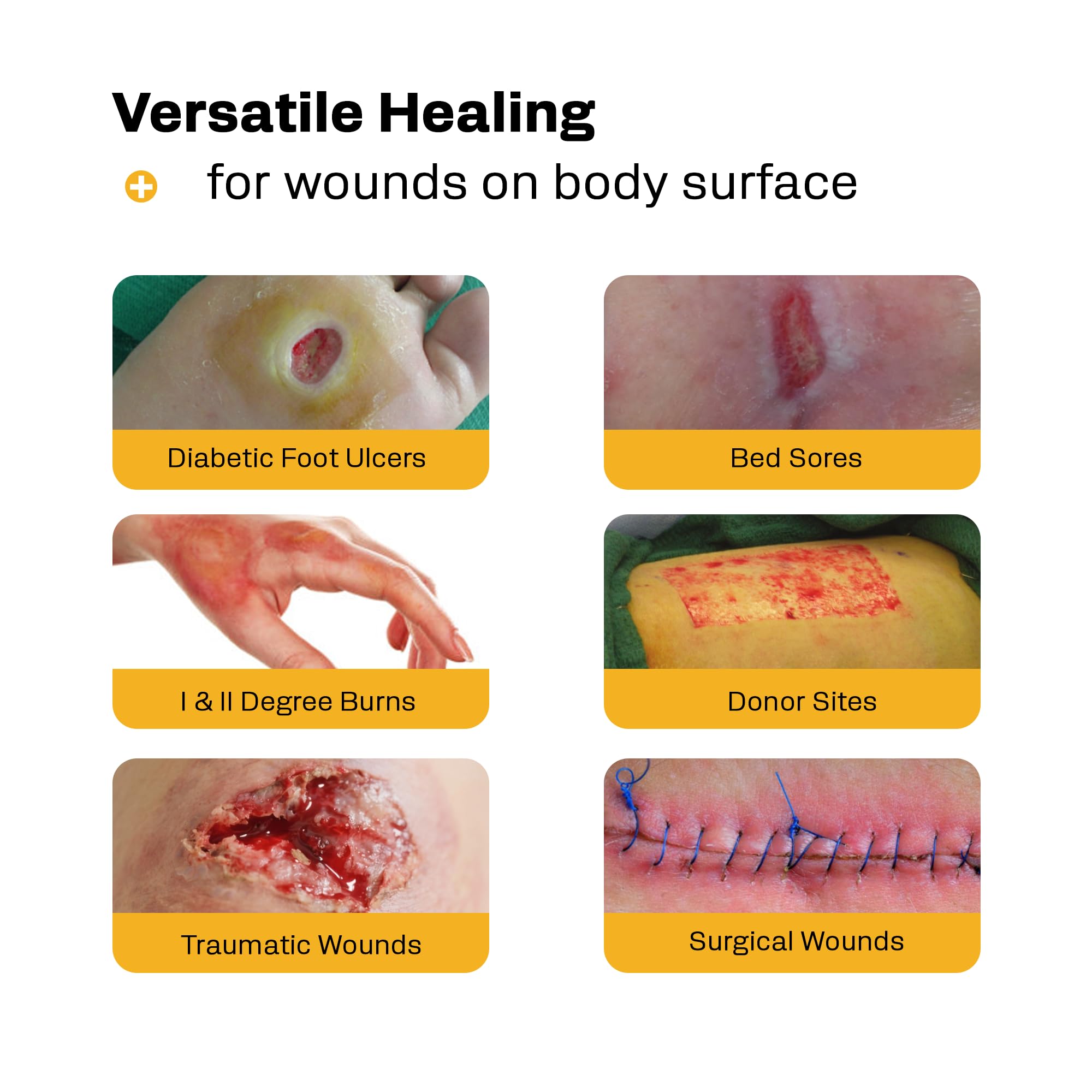 AWD Medical nonadherent gauze dressing eases removal while protecting the wound site.
