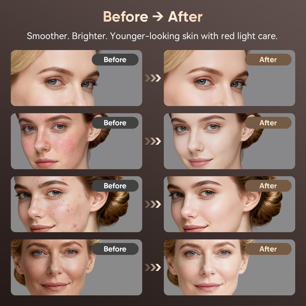 Balnore five light modes cover multiple skin needs.