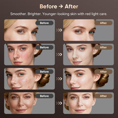 Balnore five light modes cover multiple skin needs.