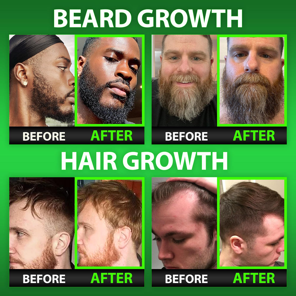 BBS Best Beard Stuff bottle cap closeup highlighting premium biotin formula benefits for beard.
