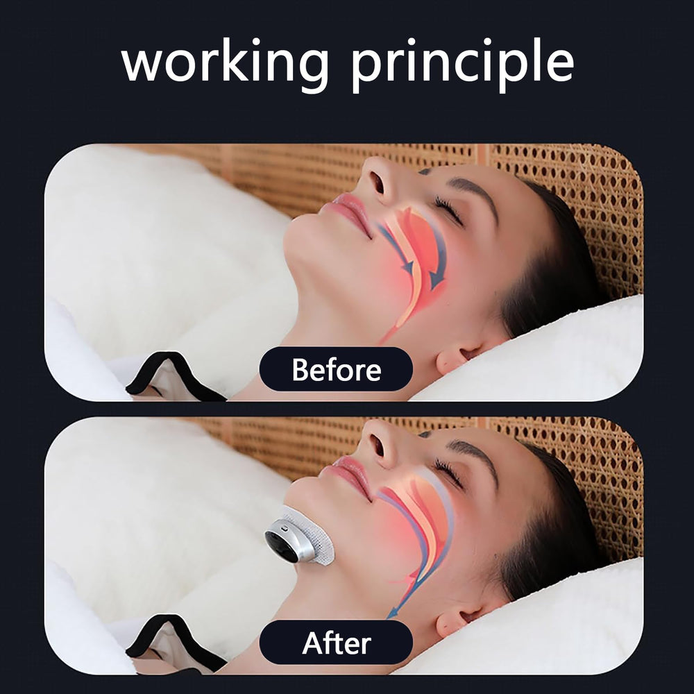 BEBESIRI Anti-Snoring Aid three gear settings for personalized comfort