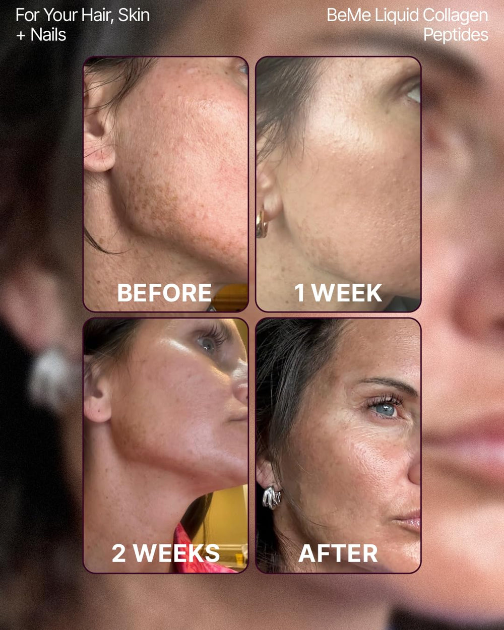 BeMe peach flavor pack shown for convenient daily collagen dosing.