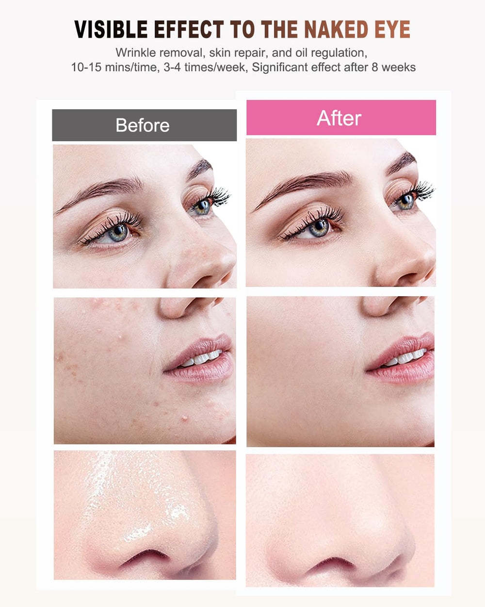 BETNEP Soft silicone mask texture for gentle, comfortable wear.