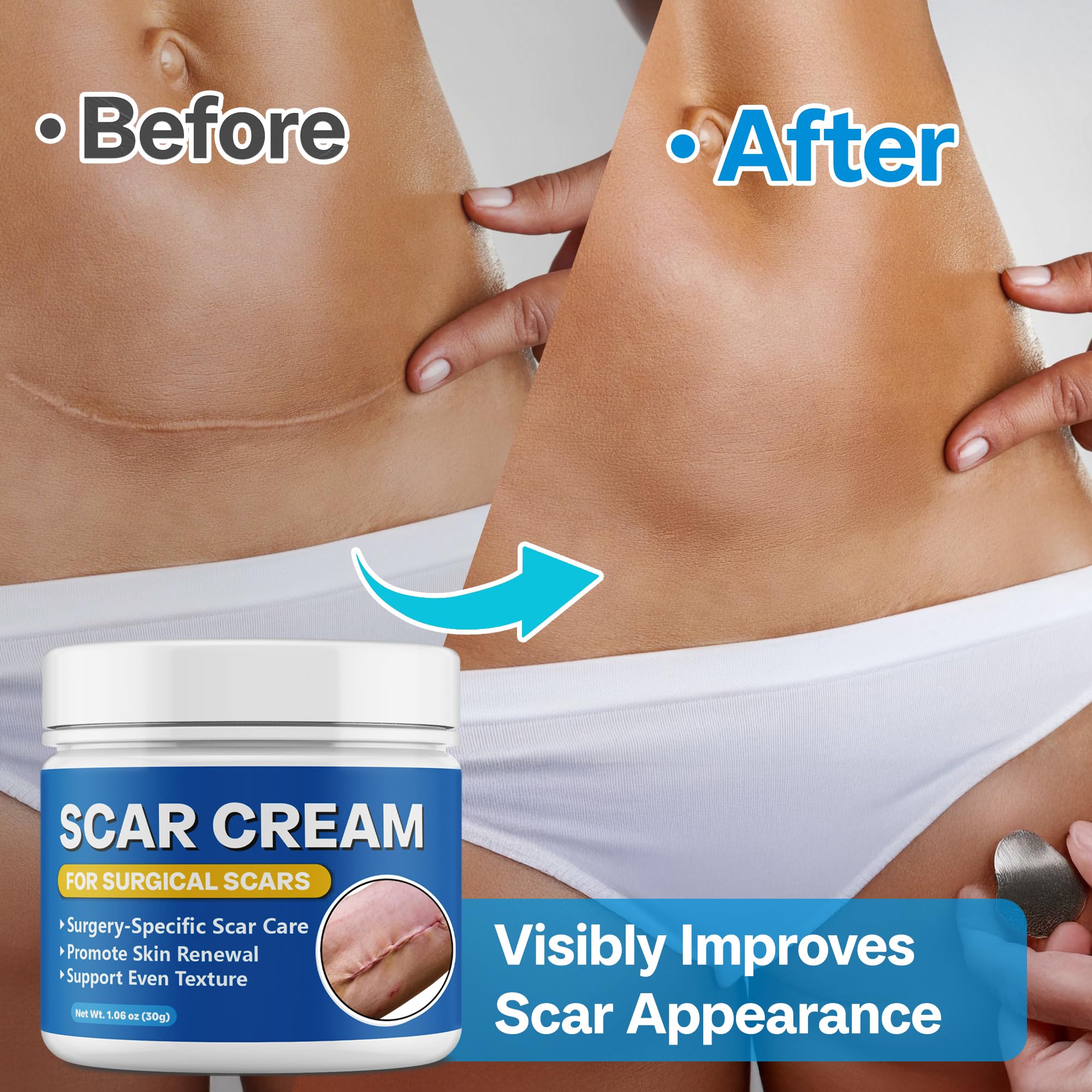 Bingbrofam Scar Cream pump jar demonstrating hygienic packaging for easy daily application