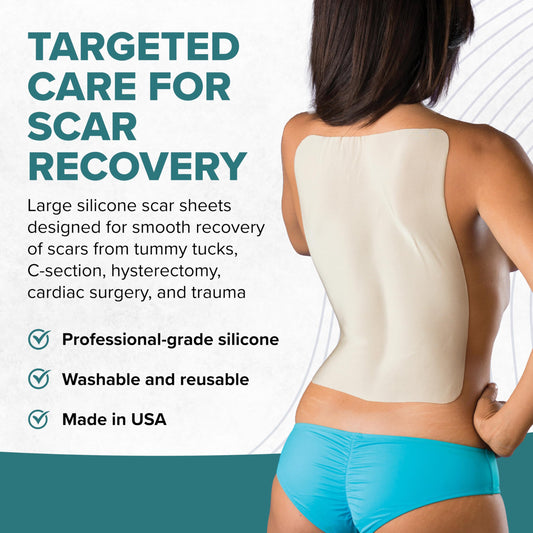 Customizable Biodermis EpiDerm Large Scar Sheet cut to fit your scar.