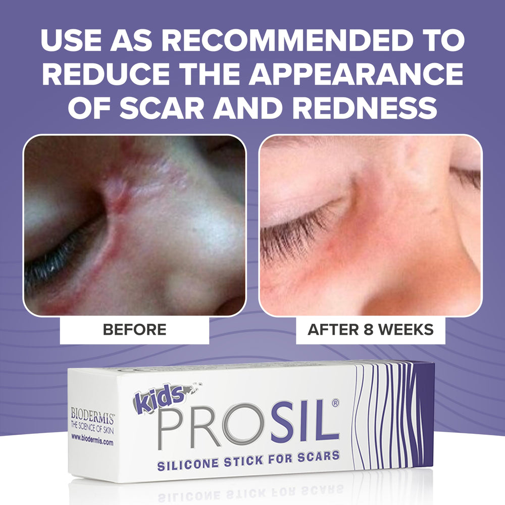 BIODERMIS Pro-SIL Kids elbow scar application for easy use