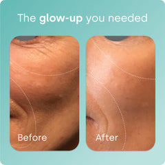 Biosil ch-OSA activator science graphic illustrating collagen activation potential