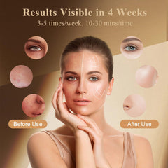 biuufish soft silicone mask that's skin-friendly and comfortable