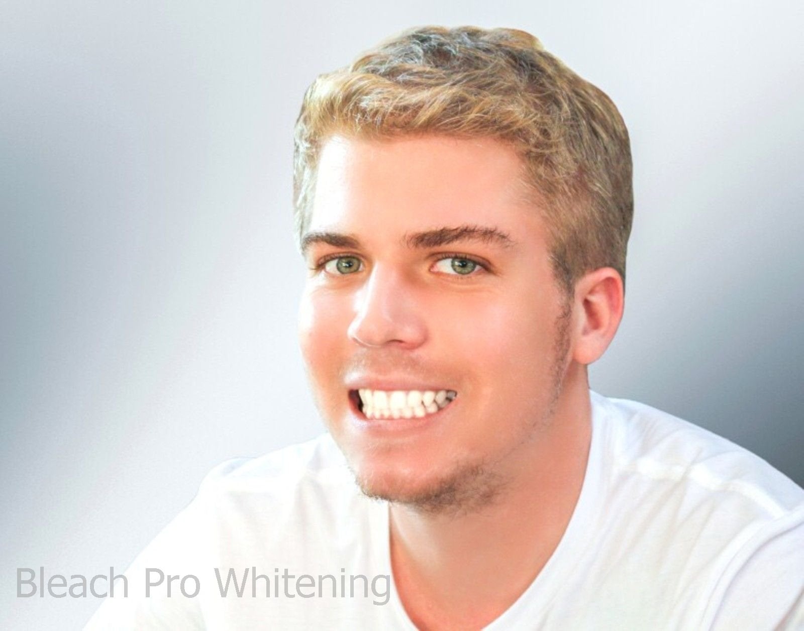 Bleach Pro Whitening gel syringes arranged as a complete at-home kit.