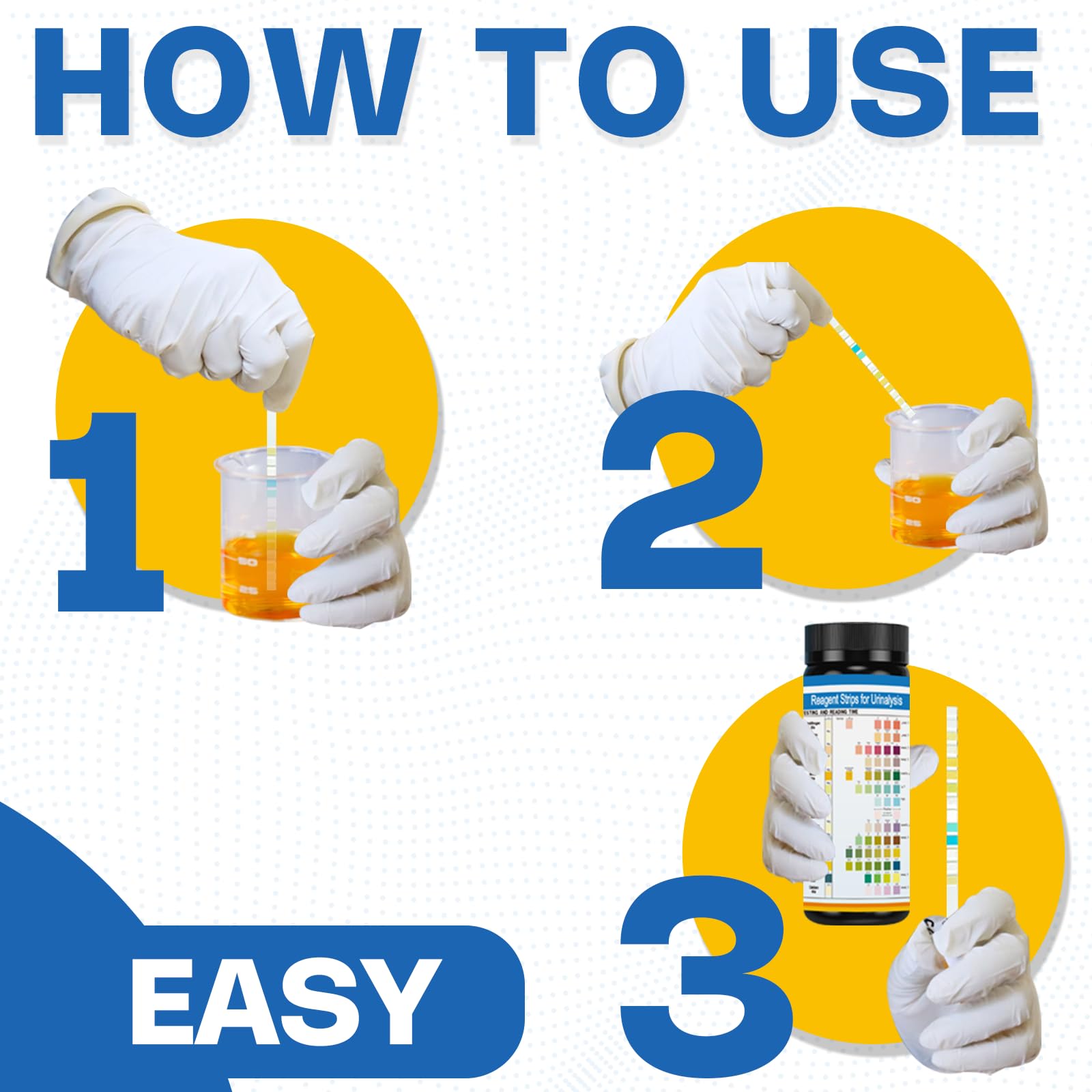 BLENSTCS URS parameters chart displays multiple urine markers