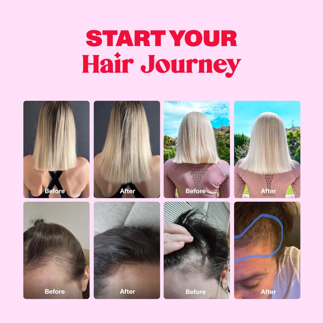Bloom Robbins Hair Gummy child-safe-cap image signals worry-free mom routine.