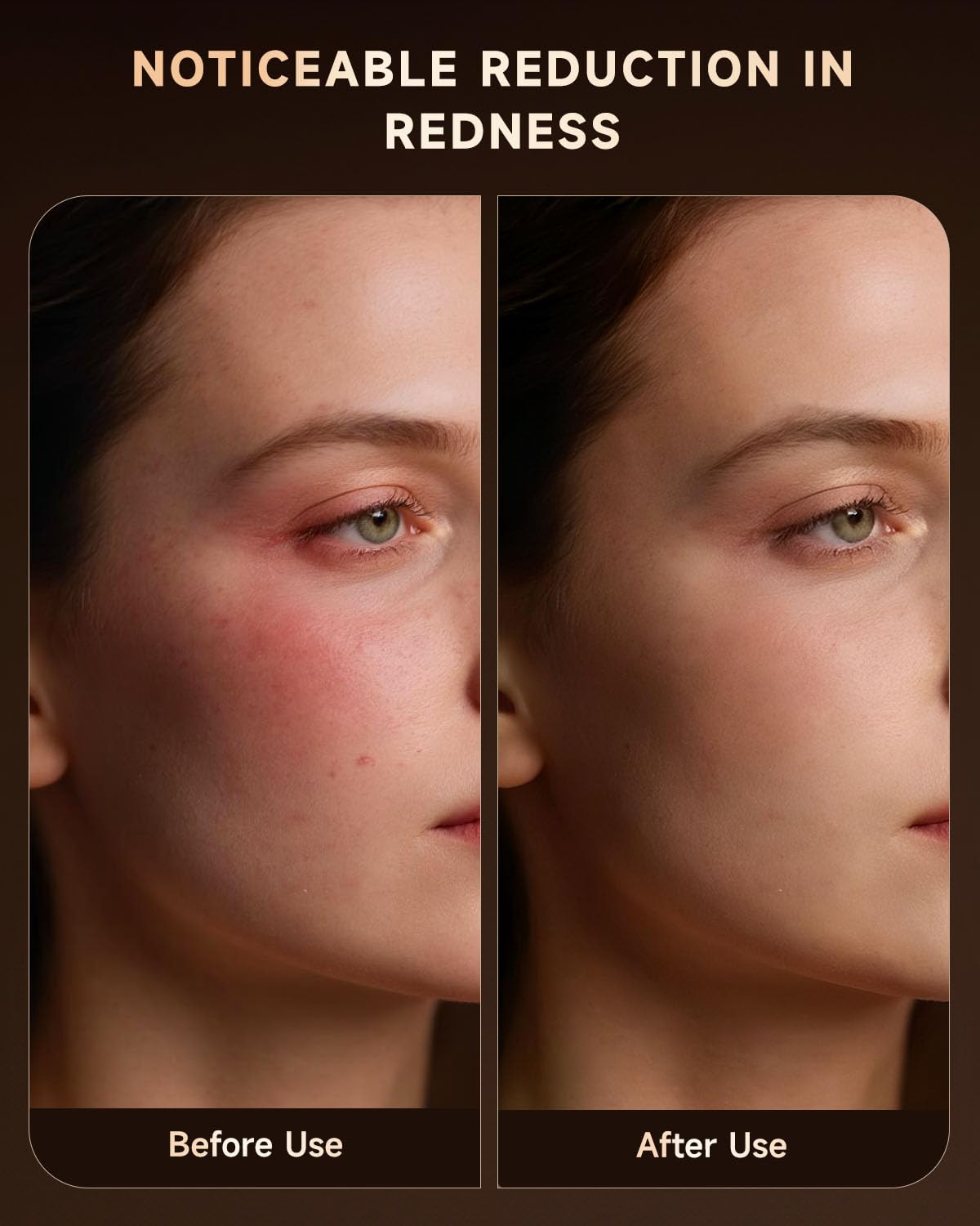 BMONATY mask on neck and hands demonstrates versatile treatment options