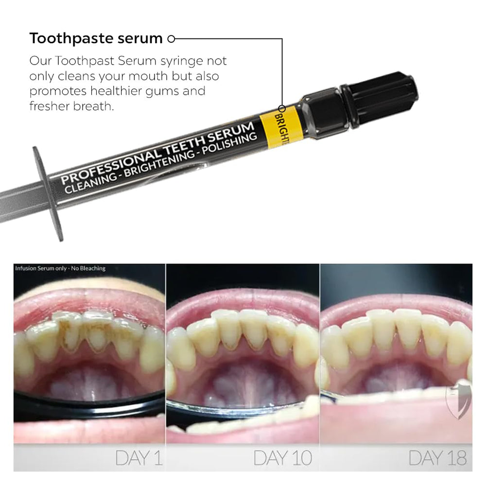 Complete Bilistic Pro-Series kit including polisher, LED pack, and detox serum.