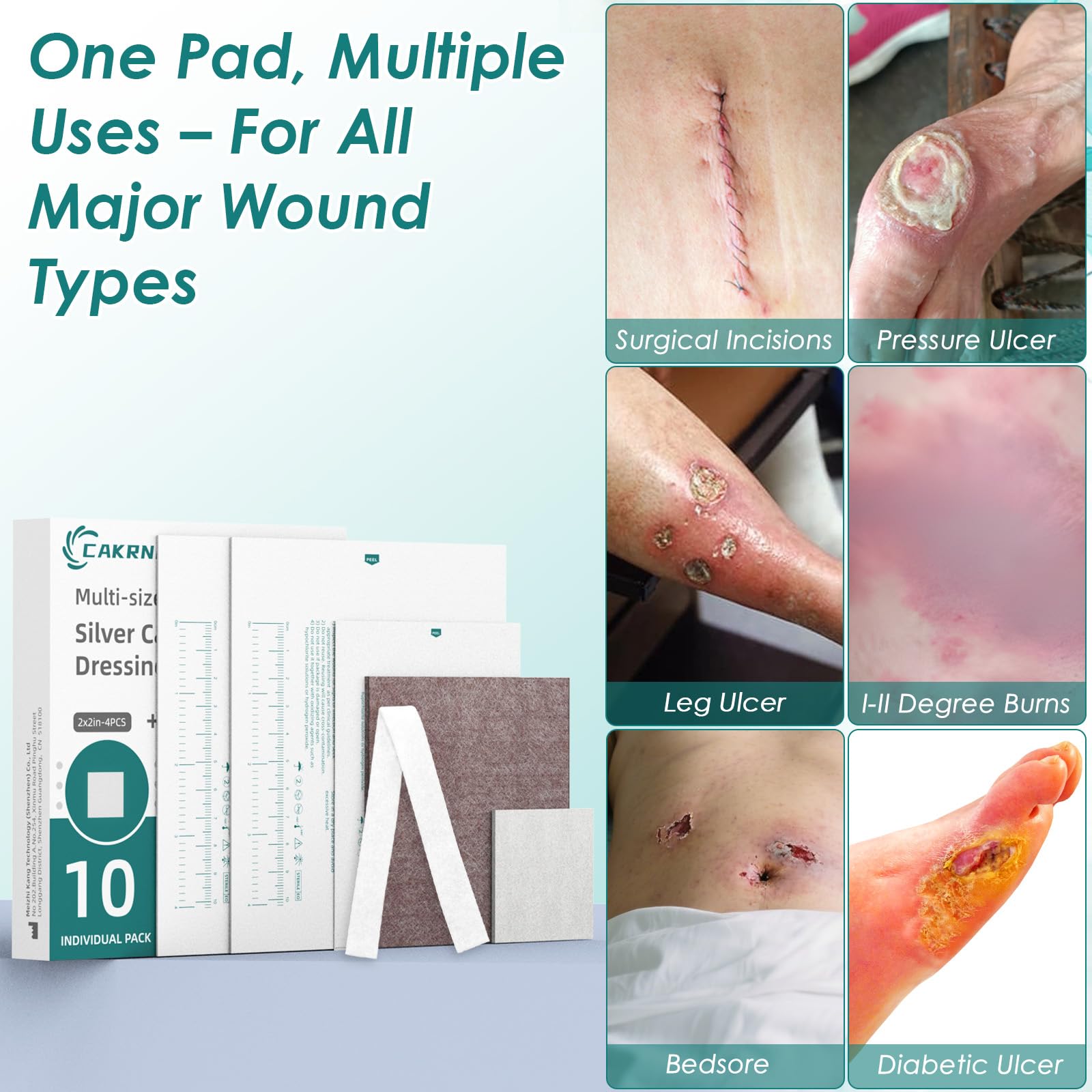 CAKRNPS dressing for diabetic ulcers offers flexible care options