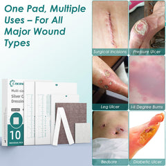 CAKRNPS dressing for diabetic ulcers offers flexible care options