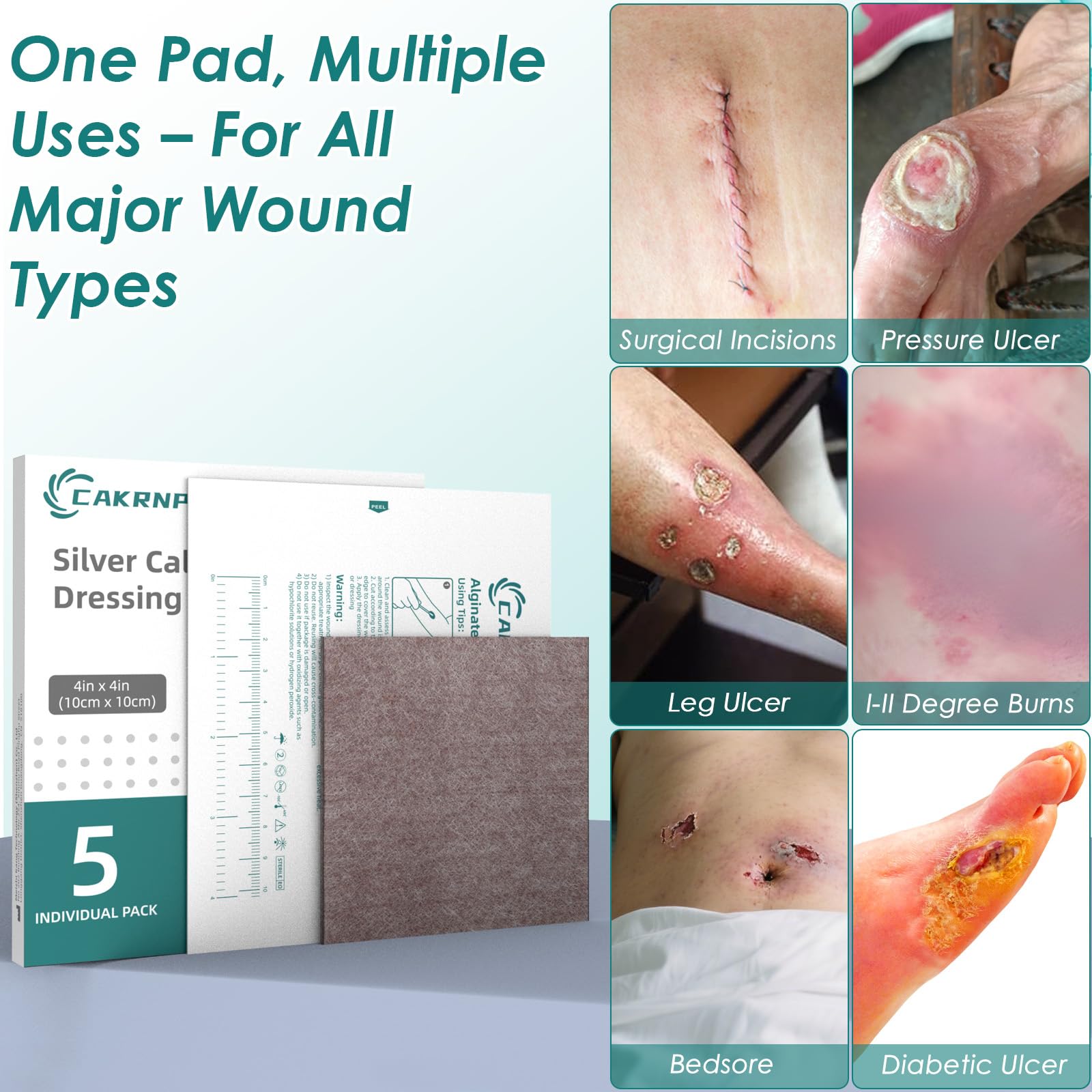 CAKRNPS silver ion-infused dressing provides protective wound care.