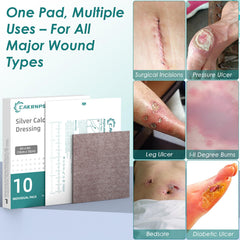CAKRNPS Silver-ion protection helps manage exudate.