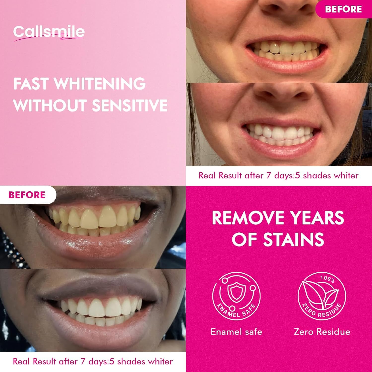 Callsmile Teeth Whitening Strips Strip Application demonstrates gentle use for sensitive enamel