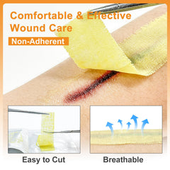 CARBOU non-adherent gauze patch reduces pain during dressing changes.