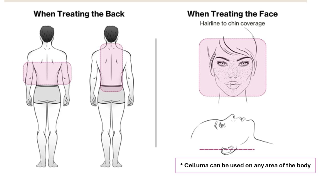 Celluma PRO panel pain relief area showing hands-free therapy for relief and comfort