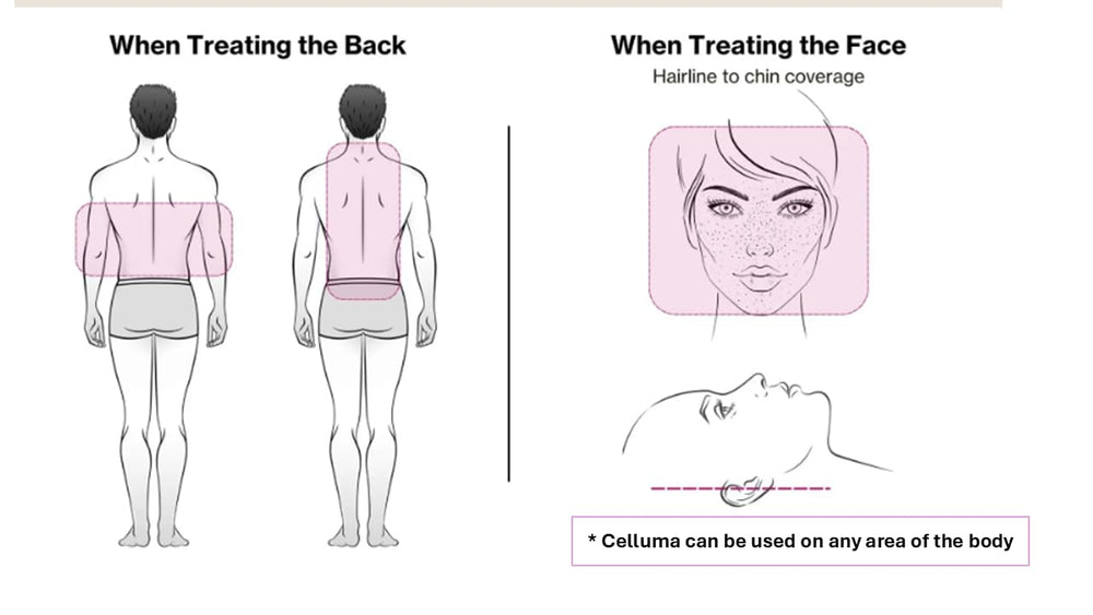 Celluma PRO panel pain relief area showing hands-free therapy for relief and comfort