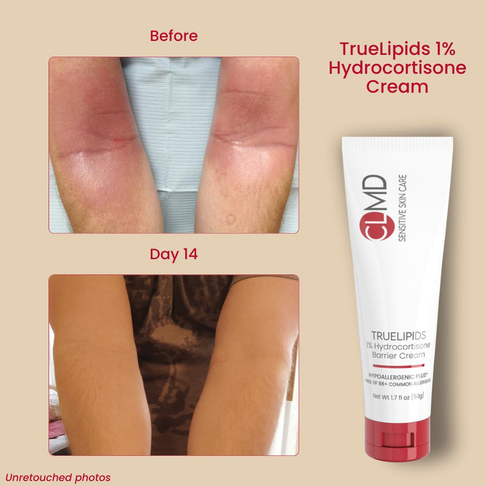Cheryl Lee MD TrueLipids CLMD cream texture close-up showing creamy hydration.