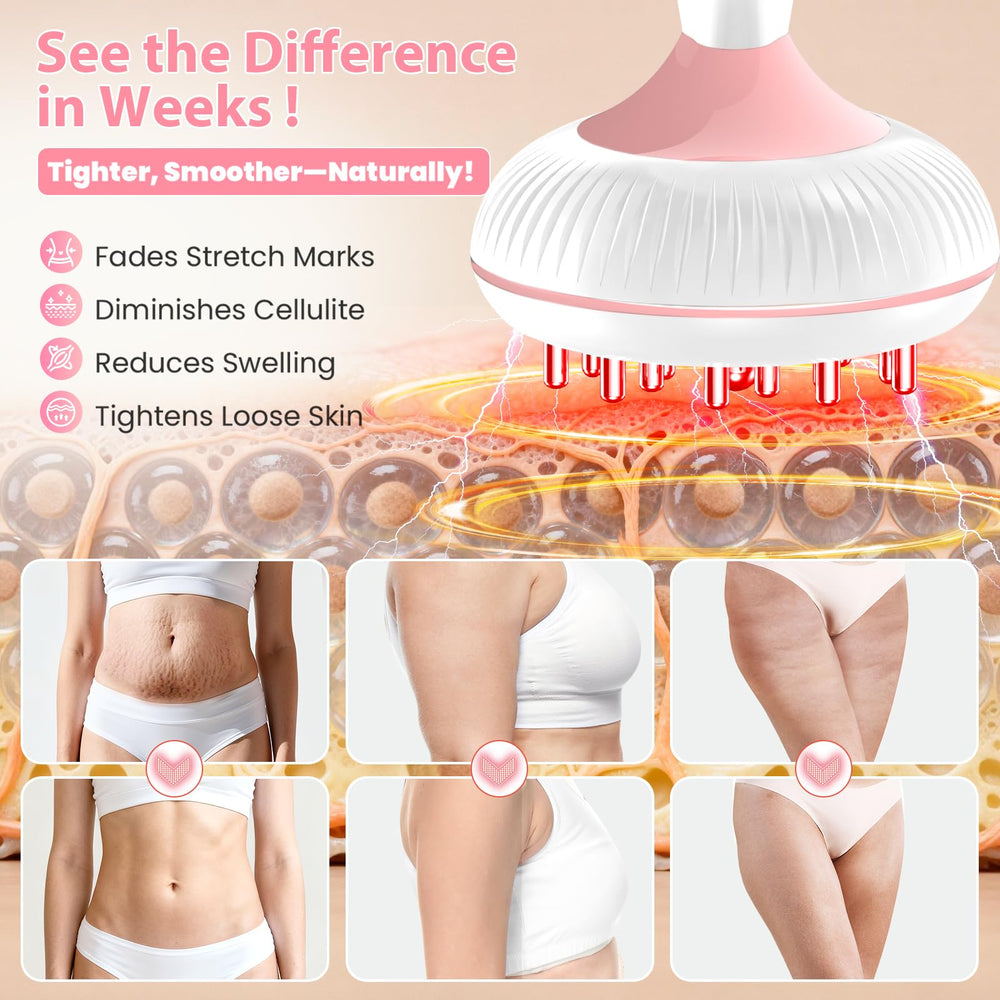 Choufaly device features light, heat, and vibration therapies.