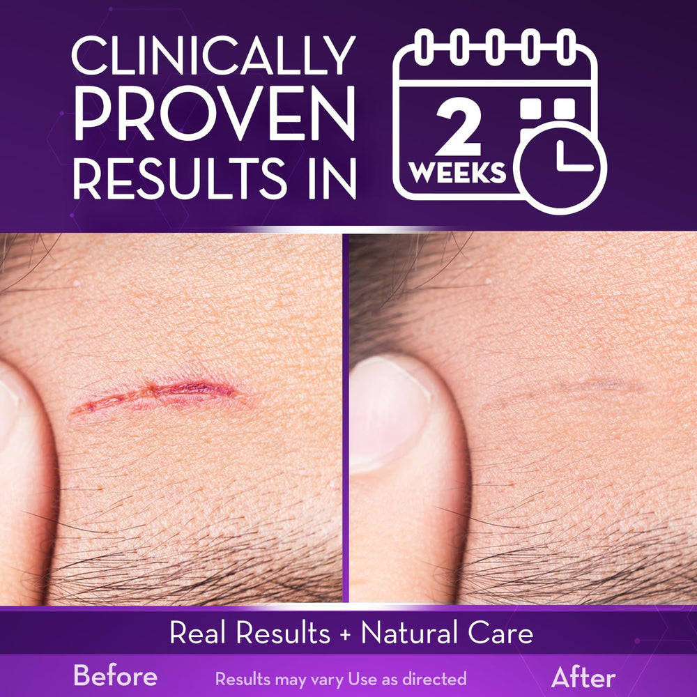 Close-up of Cicatricure gel over a surgical scar for improved appearance