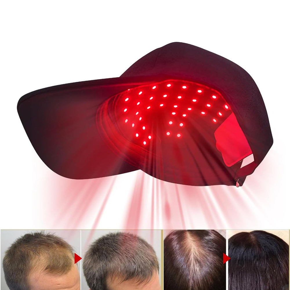 cilate LLLT cap with detachable patch enables flexible styling