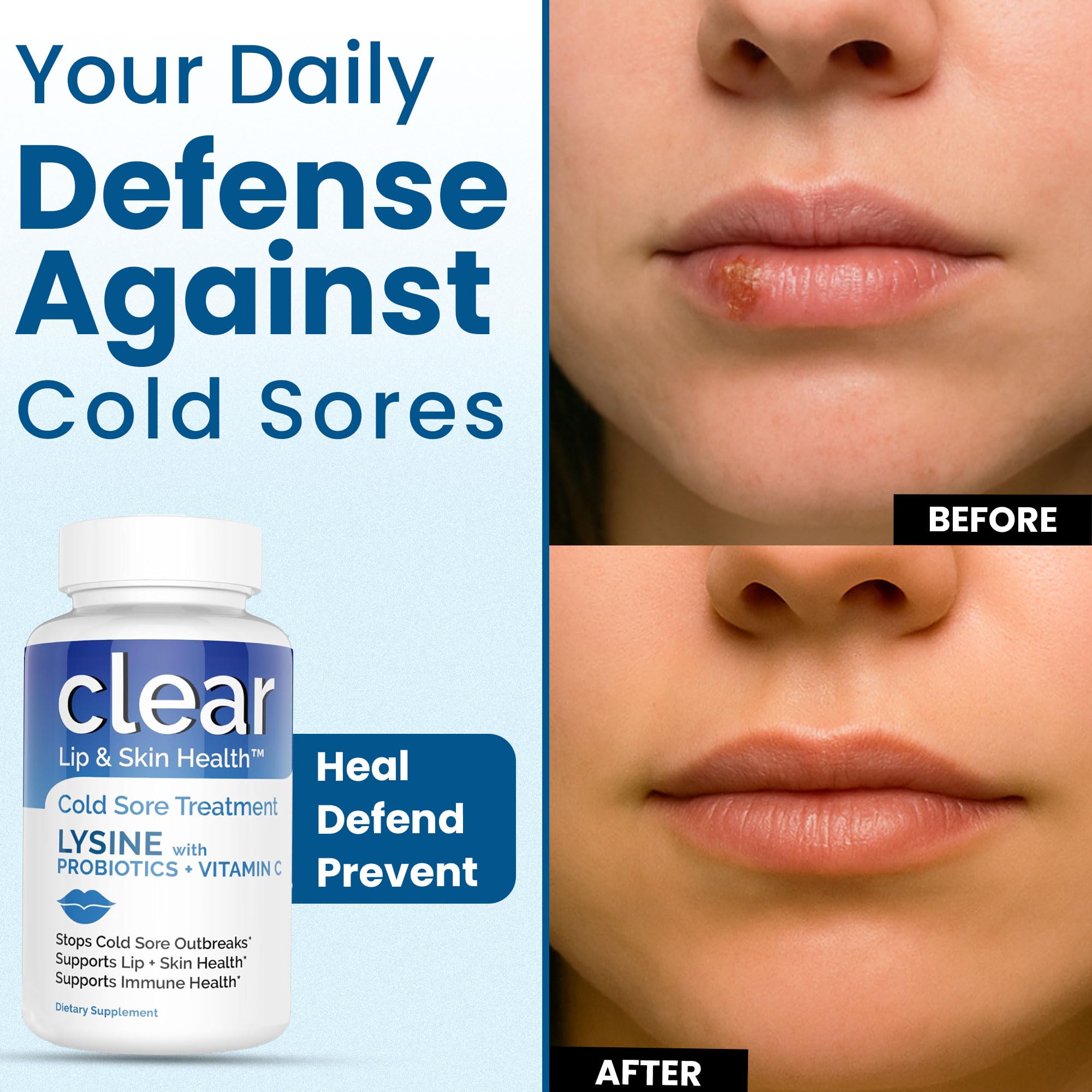 Clear Probiotics lysine packaging box for convenient daily use.