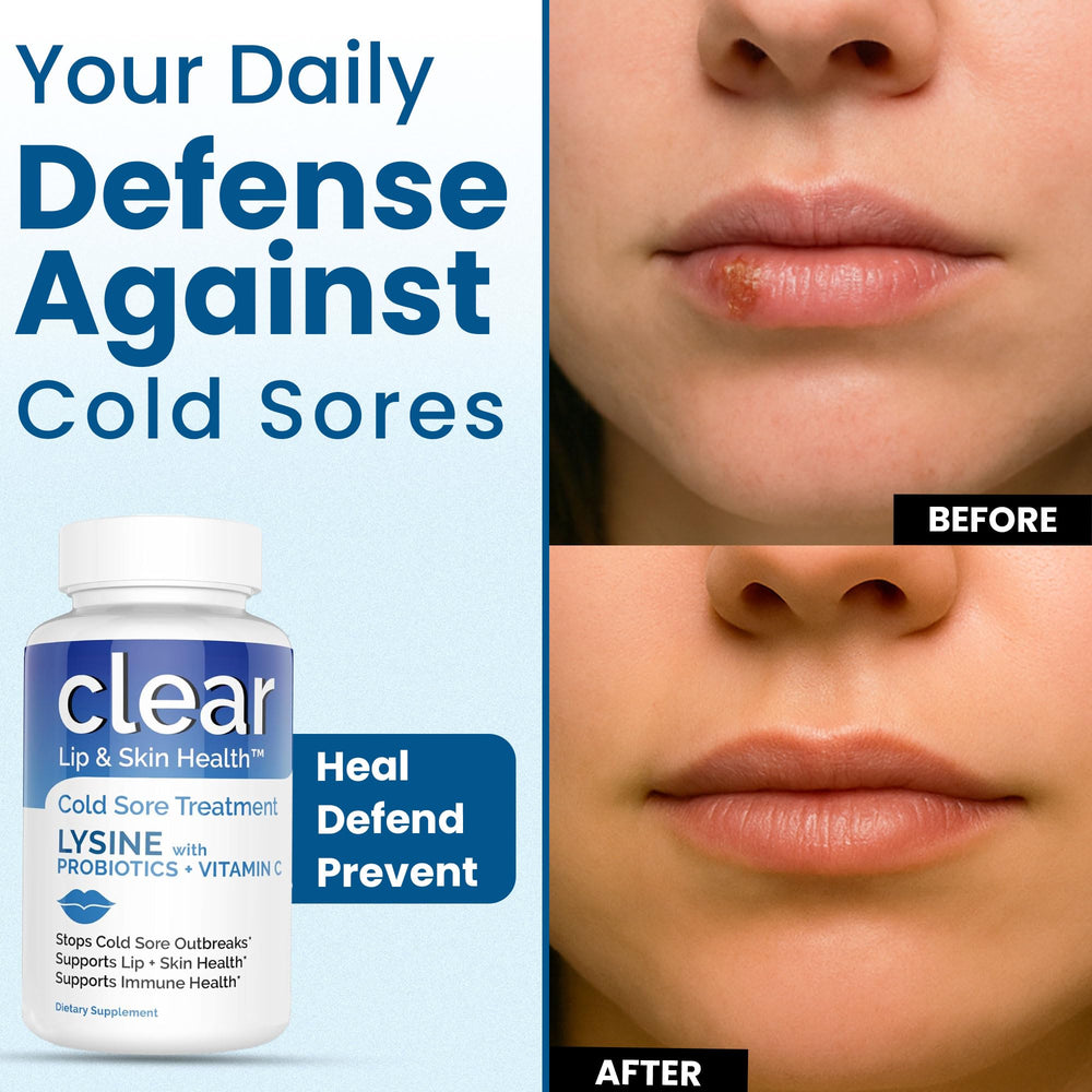 Clear Probiotics lysine packaging box for convenient daily use.