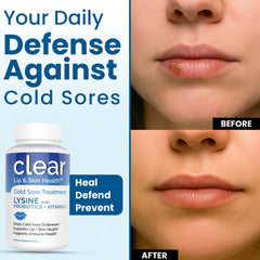 Clear Probiotics lysine packaging box for convenient daily use.