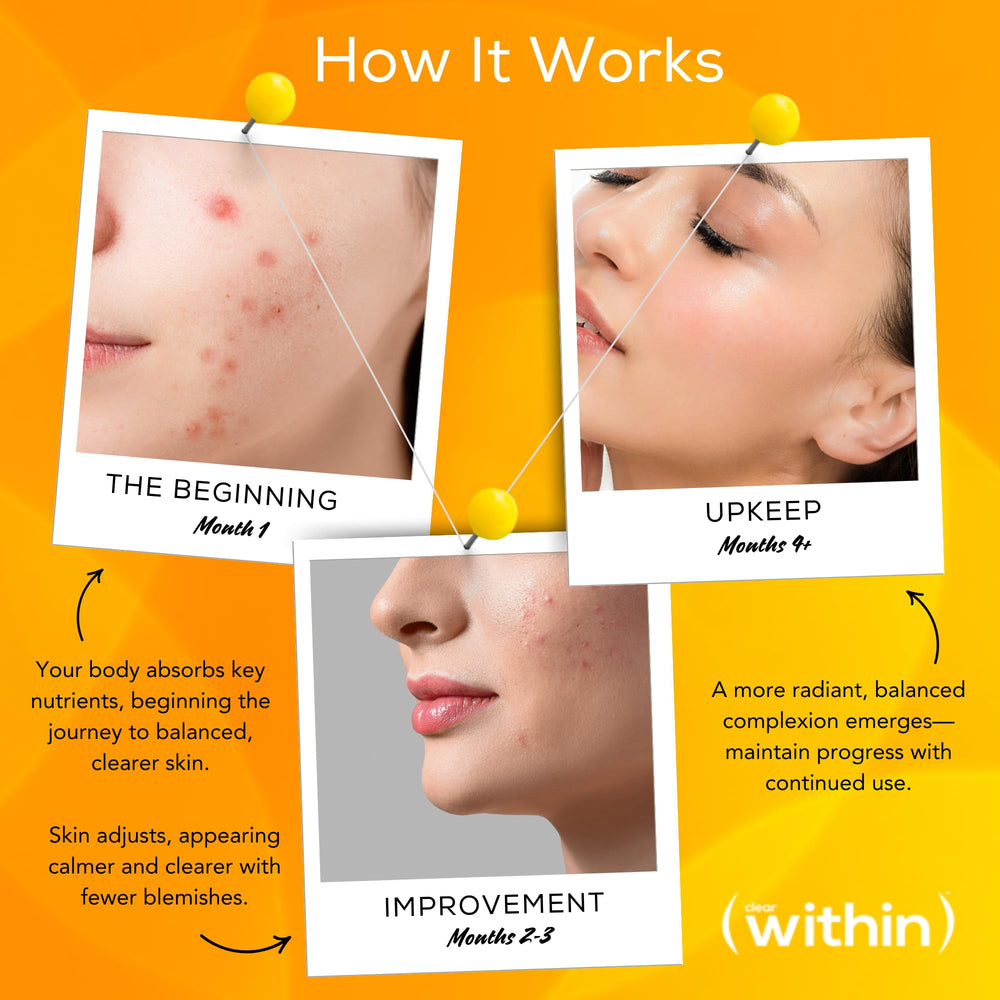 Clear Within plant-based ingredients illustration emphasizes pure, synthetic-free skincare