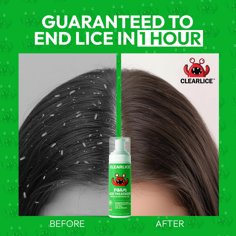 Clearlice USA-made GMP lab backing ensures quality, safety, and trust.