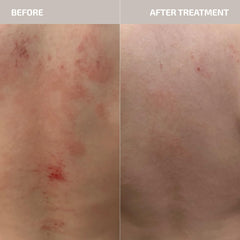 Codex Labs ANTŪ dermatologist-tested product badge