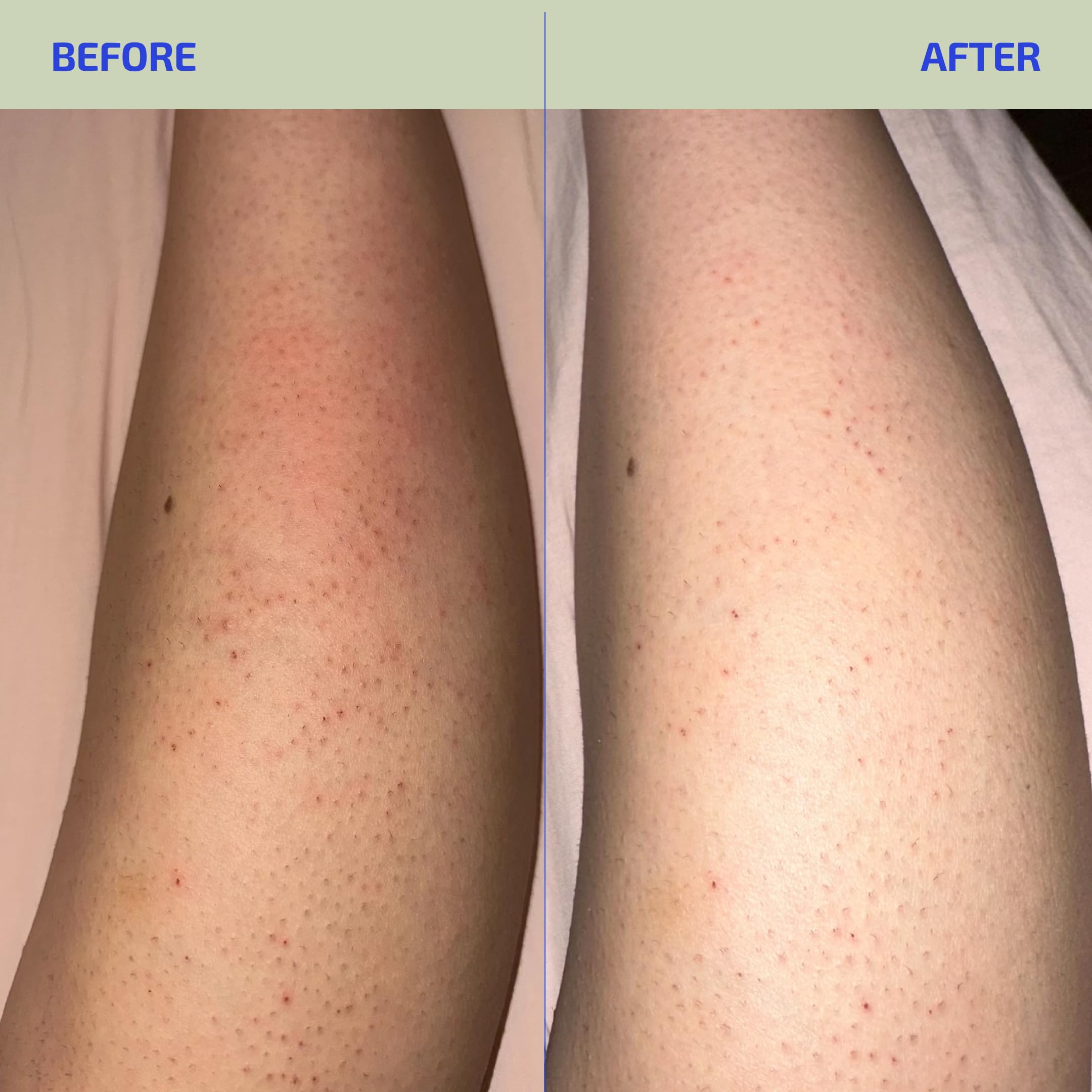 Codex Labs BIA Eczema Relief Lotion all-ages care image reinforces safety for babies to adults