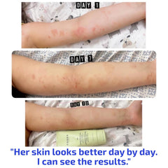 Codex Labs BIA Eczema Relief Lotion application scene highlights lightweight hydration with no residue