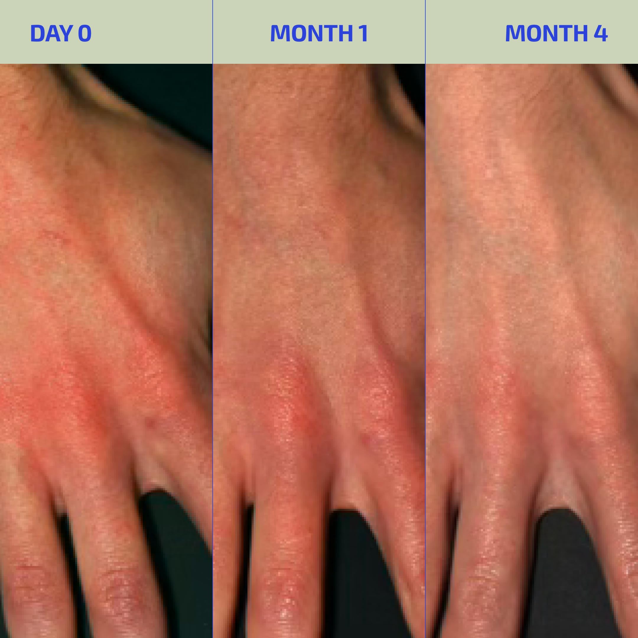 Codex Labs BIA Eczema Relief Lotion close-up shows soothing hydration for eczema-prone skin