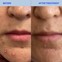 Close-up of Shaant Skin ingredients panel featuring myo-inositol and folate for balance
