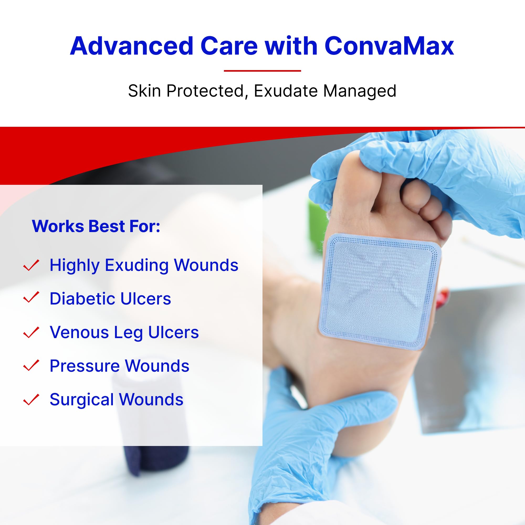 Cross-section of air-permeable nonwoven layer in ConvaMax dressing providing breathability