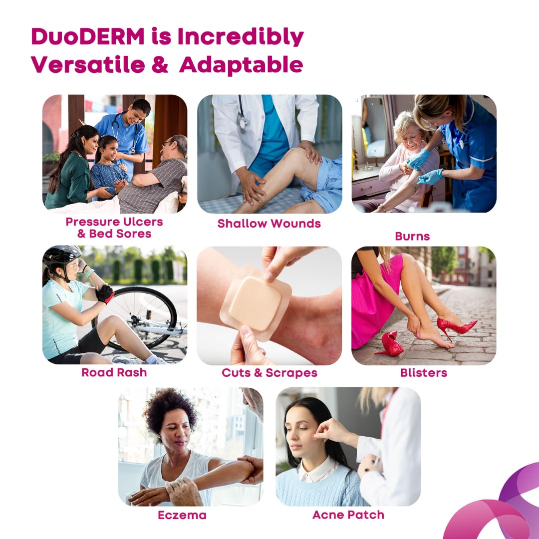 ConvaTec DuoDERM dressing moldable edges reduce friction