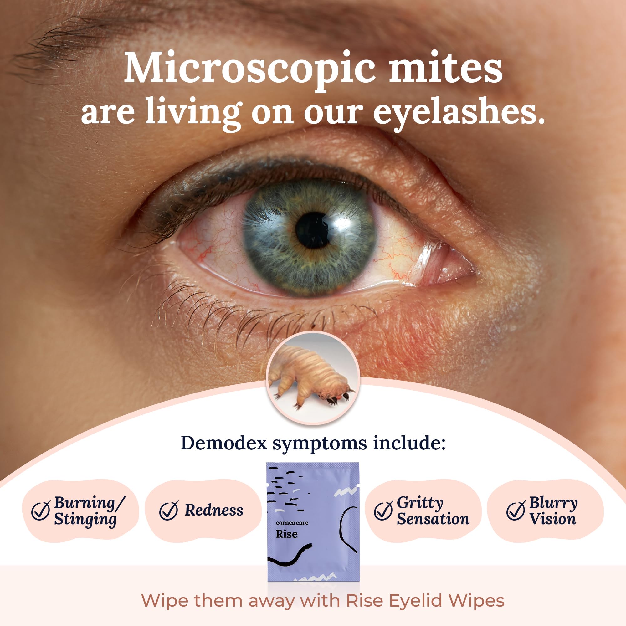 CorneaCare Rise eyelid wipe being used for delicate lid cleansing