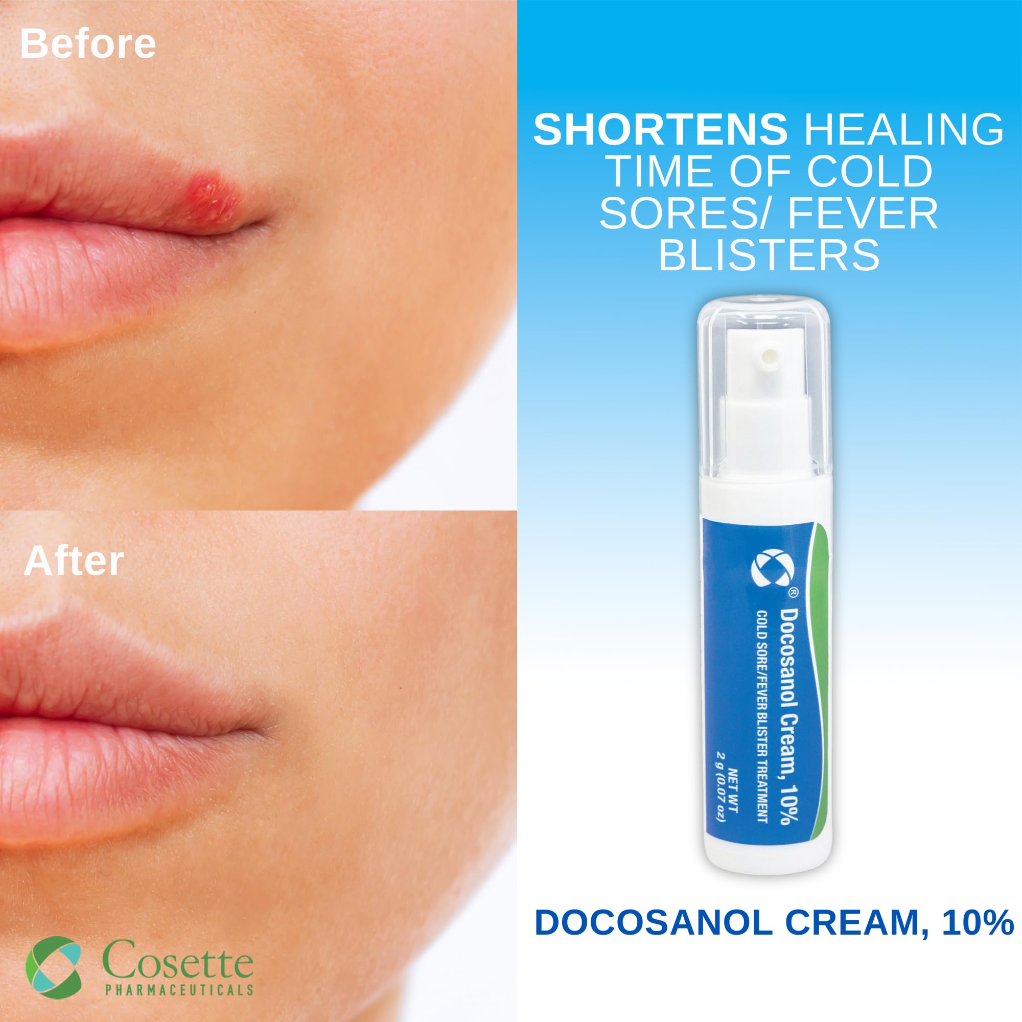 Cosette docosanol cream close-up on fingertip shows ready-to-use design.