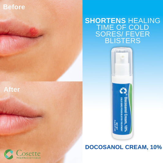 Cosette docosanol cream close-up on fingertip shows ready-to-use design.